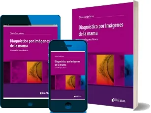 Diagnostico por Imagenes de la Mama. Un Enfoque Clinico PDF para imprimir + eBook