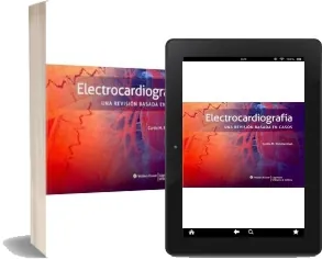 Electrocardiografia. Una Revision de Casos Curtis m. Rimmerman review + descarga [eBook] Google Drive
