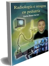 «Radiologia e Imagen en Pediatria» descargar resumen + review en Español 2022