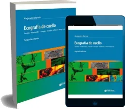 Drive Ecografia de Cuello, Tiroides, paratiroides, Salivales, Ganglios Linfaticos. Otras Neoplasias PDF gratis en Español