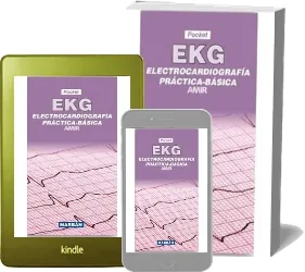 Libro Ekg Pocket - Electrocardiografía Práctica Básica completo gratis + resumen
