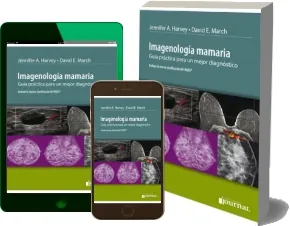 Descargar » Imagenologia Mamaria. Guia Practica para un Mejor Diagnostico » Jennifer a. Harvey » GRATIS Mega