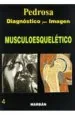 PDF Diagnostico por Imagen, Vol. 4: Musculoesqueletico del autor César s. Pedrosa