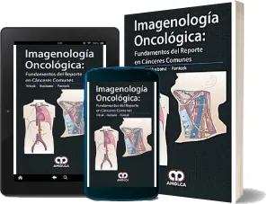 Google Books: Imagenologia Oncologica: Fundamentos Del Reporte en Canceres Comunes de Hedvig Hricak en Español CBR, PDF, DOC, DOCX, WORD, TXT, GIF, EPUB descargas ilimitadas