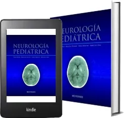 Descargar «Neurologia Pediatrica» PDF completo eBook 2022 Google Drive