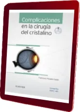 Bajar «Complicaciones en la Cirugia Del Cristalino» de Francisco Poyales Galan - 2022 (Elsevier) Google Drive