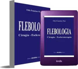 Descarga PDF Flebologia o eBook + resumen