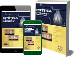 Descargar gratis Estetica en Odontologia Restauradora de Gilberto Henostroza Libro completo + resumen PDF 9 páginas | eBook Sin registro ThePirateBay, MEGA, Google Drive, MediaFire, pCloud, WeTransfer, Microsoft OneDrive 2022