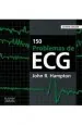 PDF 150 Problemas de Ecg del autor John r. Hampton