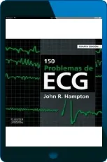 Bajar 150 Problemas de Ecg en PDF o ePub para Kindle Google Drive