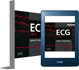Ecg Facil eBook free John r. Hampton PDF + resumen