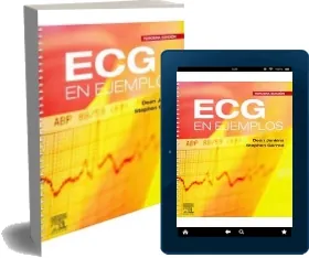 Descargar «Ecg en Ejemplos» de Dean Jenkins editorial Elsevier 2022 + ePub