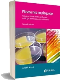 Google Books en PDF: Plasma Rico en Plaquetas, 2da. Ed. de Ana m. Arcuri en EPUB, AZW3, TXT, WORD, DOCX, DOC, PDF, CBR edición 2022 | Kindle - iPad versión completa