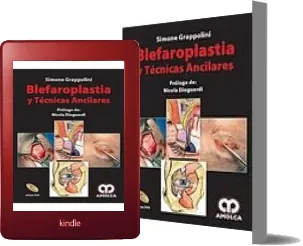 PDF «Blefaroplastia y Tecnicas Ancilares» - Simone Grappolini - Descargar GRATIS 2022 + eBook