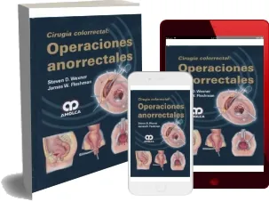 eBook descarga Cirugia Colorrectal: Operaciones Anorrectales actualizada Google Drive