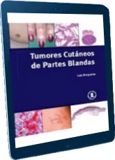 «Tumores Cutaneos de Partes Blandas» eBook descargar PDF Luis Requena 2022 Google Drive