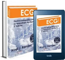 Google Books en PDF: Electrocardiografia Clinica, su Aprendizaje Razonado de Noel Ramirez en Español WORD, PDB, PDF, FB2, CBR, AZW, DOC, TCR, EPUB, DOCX, TXT Apple iCloud, MediaFire, Torrent, Toorgle, Microsoft OneDrive, SendThisFile, Dropbox edición 2022 | Kindle - iPad versión completa