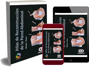 Descargar libro Atlas de Reconstruccion de la Pared Abdominal ePub