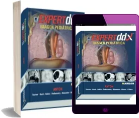«Expert Ddx: Imagen Pediatrica» review + descarga directa PDF 2022 + resumen