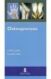 PDF Osteoporosis del autor Gavin Clunie