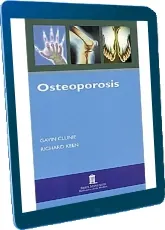 Leer «Osteoporosis» PDF online GRATIS 2022