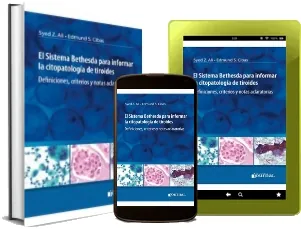Descargar PDF completo El Sistema Bethesda para Informar la Citopatologia de Tiroides gratis + eBook