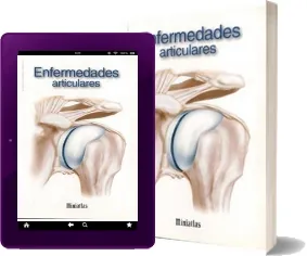 Descargar Enfermedades Articulares - Miniatlas ePub español + resumen