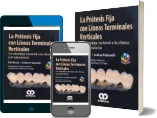 Leer y descargar La Protesis Fija Con Lineas Terminales Verticales. Un Abordaje Racional a la Clinica y al Laboratorio +Dvd online MEGA