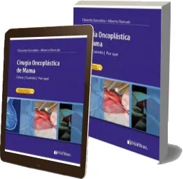 Libro gratis Cirugia Oncoplastica de Mama. Como - Cuando - Por Que actualizado + ePub