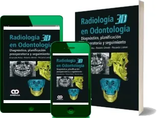 Radiologia 3d en Odontologia. Diagnostico, Planificacion Preoperatoria y Seguimiento PDF descarga gratuita + resumen