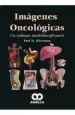 PDF Imagenes Oncologicas. Un Enfoque Multidisciplinario del autor Paul Silverman