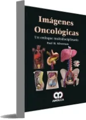 [DESCARGAR] «Imagenes Oncologicas. Un Enfoque Multidisciplinario» GRATIS PDF | Paul Silverman 2022 + eBook