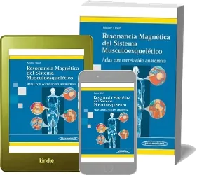 Drive Resonancia Magnetica Del Sistema Musculoesqueletico. Atlas Con Correlacion Anatomica PDF descargar 292 páginas de la editorial Medica Panamericana
