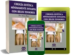 Gratis «Cirugia Estetica Minimamente Invasiva Con Hilos Tensores» Descargar | Pier Antonio Bacci + eBook