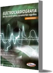 eBook español Electrocardiografia de Los sindromes Coronarios Agudos + resumen