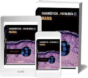 Bajar Diagnostico en Patologia - Mama Libro completo edición 2022 | Resumen 