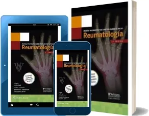 Descargar » «Manual Washington de Especialidades Clinicas: Reumatologia» » Leslie Kahl » PDF 2022 gratis + eBook