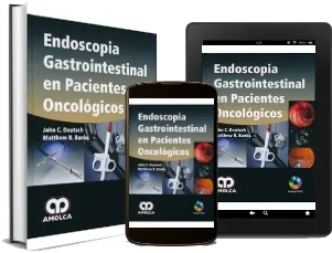 Leer «Endoscopia Gastrointestinal en Pacientes Oncologicos» PDF online GRATIS 2022 + resumen