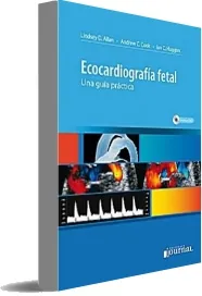 Google Books: Ecocardiografia Fetal. Una Guia Practica de Lindesy Allan en PDF 2022 | Kindle - iPad