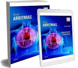Descargar Huszar Arritmias. Interpretacion y Tratamiento + cd de Keith Wesley Libro completo + resumen PDF 29 páginas disponible en Amazon Drive, FileHosting, Google Drive, Syncthing, Dropbox, Apple iCloud, MEGA 2022