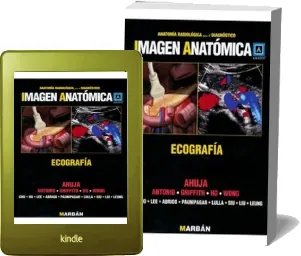 Descargar resumen «Imagen Anatomica. Ecografia» gratis 2022