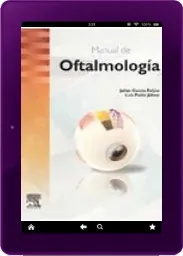 Descargar Manual de Oftalmologia idioma Español + resumen