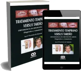 Tratamiento Temprano Versus Tardio. Ortodoncia en Denticion Mixta. Diagnostico y Tratamiento completo descargar gratis Mega