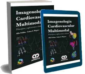 Descargar Imagenologia Cardiovascular Multimodal. Principios y Aplicaciones Clinicas de Olle Pahlm PDF 2022