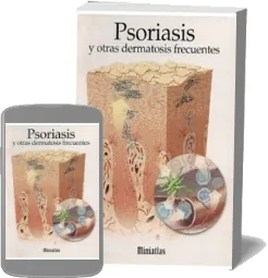 PDF «Psoriasis y Otras Dermatosis Frecuentes - Miniatlas» en Español 2022 Mega