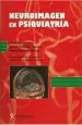 PDF Neuroimagen en Psiquiatría del autor Celso Arango