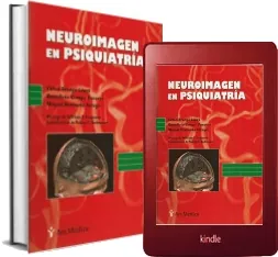 Neuroimagen en Psiquiatría Descargar libro actualizado + ePub