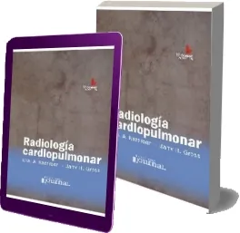 Radiologia Cardiopulmonar libro en español Google Drive