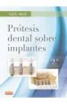 PDF Protesis Dental sobre Implantes, 2da. Ed. del autor Carl Misch