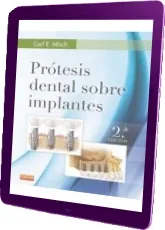 Protesis Dental sobre Implantes, 2da. Ed. descarga gratuita Mega